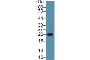 Western Blot; Sample: Rat Heart; Primary Ab: 1µg/ml Mouse Anti-Rabbit NT-ProBNP Antibody Second Ab: 0. (NT-ProBNP Antikörper)