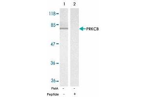 Western blot analysis of exreacts from K-562 untreated or treated with PMA (1 ng/mL, 10 min) using PRKCB polyclonal antibody .