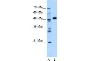 WB Suggested Anti-GPT Antibody Titration:  1.