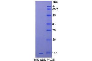 SDS-PAGE analysis of Mouse Serum Amyloid A Protein. (SAA Protein)