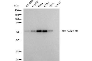 Western blotting analysis using Keratin 10 antibody (ABIN7799163).