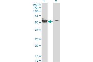 Western Blot analysis of STK38 expression in transfected 293T cell line by STK38 monoclonal antibody (M01A), clone 2G8-1F3. (STK38 Antikörper  (AA 1-465))