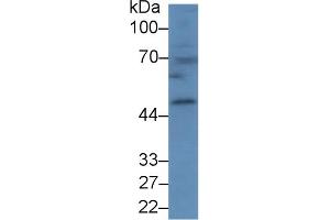 Detection of CPB1 in Mouse Spleen lysate using Polyclonal Antibody to Carboxypeptidase B1, Tissue (CPB1) (CPB1 Antikörper  (AA 109-415))