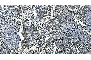 IHC analysis of PCBP2/hnRNP E2 using anti-PCBP2/hnRNP E2 antibody (ABIN7600449). (PCBP2 Antikörper  (AA 197-276))