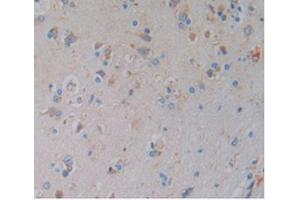 Detection of HO1 in Human Brain Tissue using Monoclonal Antibody to Heme Oxygenase 1 (HO1) (HMOX1 Antikörper  (AA 61-172))