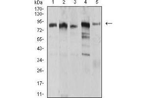 Western blot analysis using UHRF1 mouse mAb against MCF-7 (1), HCT116 (2), HL-60 (3), Hela (4), and HEK293 (5) cell lysate.