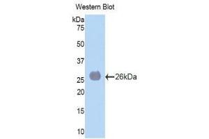 Western Blotting (WB) image for anti-Laminin, alpha 4 (LAMa4) (AA 745-940) antibody (ABIN1859600)
