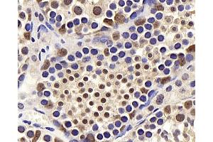 Immunohistochemistry analysis of paraffin-embedded mouse testis using BRAF Polyclonal Antibody at dilution of 1:400. (BRAF Antikörper)