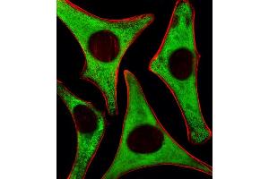 Fluorescent image of Hela cells stained with RPS6 Antibody (N-term) . (RPS6 Antikörper)