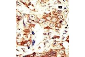 Image no. 2 for anti-Insulin Receptor-Related Receptor (INSRR) (C-Term) antibody (ABIN359889) (INSRR Antikörper  (C-Term))