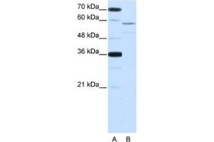 Western Blotting (WB) image for anti-Neuro-Oncological Ventral Antigen 2 (NOVA2) antibody (ABIN2462125)