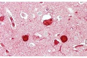 Detection of ABCG1 in Human Cerebrum Tissue using Polyclonal Antibody to ATP Binding Cassette Transporter G1 (ABCG1) (ABCG1 Antikörper  (AA 79-312))