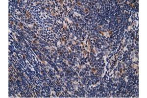 Image no. 10 for anti-EPM2A (Laforin) Interacting Protein 1 (EPM2AIP1) antibody (ABIN1498047) (EPM2AIP1 Antikörper)