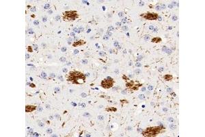 Immunohistochemistry analysis of paraffin-embedded rat brain using,PGS1 (ABIN7075039) at dilution of 1: 600 (PGS1 Antikörper)
