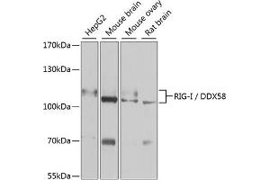 Western blot analysis of extracts of various cell lines, using Rig-I/DDX58 antibody (ABIN6130263, ABIN6139513, ABIN6139515 and ABIN6217394) at 1:1000 dilution. (DDX58 Antikörper  (AA 726-925))