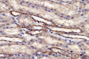 Immunohistochemistry (Paraffin-embedded Sections) (IHC (p)) image for anti-Proteasome (Prosome, Macropain) 26S Subunit, Non-ATPase, 8 (PSMD8) antibody (ABIN7075226)