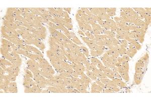 Detection of SLN in Human Cardiac Muscle Tissue using Polyclonal Antibody to Sarcolipin (SLN) (SLN Antikörper  (AA 1-31))