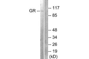 Western blot analysis of extracts from HeLa cells treated with PMA (125ng/ml, 30min), using GR (epitope around residue 211) antibody (ABIN5976159, Line 1 and 2). (GR (Internal Region), (pSer211) Antikörper)