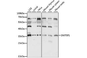 Western blot analysis of extracts of various cell lines, using DNTTIP1 antibody (ABIN6290313) at 1:1000 dilution. (DNTTIP1 Antikörper)