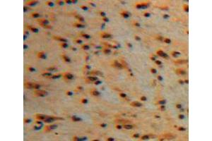 IHC-P analysis of brain tissue, with DAB staining. (PKC gamma Antikörper  (AA 351-614))