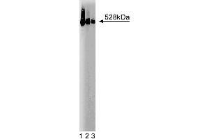 Western blot analysis of BRUCE on a SW-13 cell lysate (Human adrenal gland carcinoma, ATCC CCL-105). (BIRC6 Antikörper  (AA 372-571))