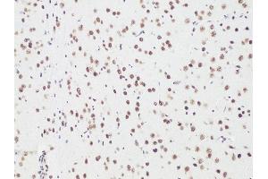 Immunohistochemistry of paraffin-embedded Rat brain using Bcl9 antibody (ABIN6129972, ABIN6137514, ABIN6137515 and ABIN6222543) at dilution of 1:100 (20x lens).