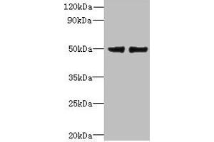 Western blot All lanes: FAM118B antibody at 12 μg/mL Lane 1: Jurkat whole cell lysate Lane 2: U251 whole cell lysate Secondary Goat polyclonal to rabbit IgG at 1/10000 dilution Predicted band size: 39 kDa Observed band size: 39 kDa (FAM118B Antikörper  (AA 83-351))