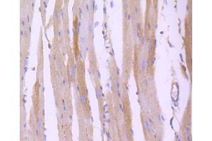 Immunohistochemistry of paraffin-embedded mouse heart using ROCK1 antibody (ABIN5997107) at dilution of 1/100 (40x lens). (ROCK1 Antikörper)