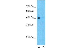 Host:  Rabbit  Target Name:  SPOP  Sample Type:  Hela  Lane A:  Primary Antibody  Lane B:  Primary Antibody + Blocking Peptide  Primary Antibody Concentration:  1ug/ml  Peptide Concentration:  5ug/ml  Lysate Quantity:  25ug/lane/lane  Gel Concentration:  0. (SPOP-B Antikörper  (C-Term))