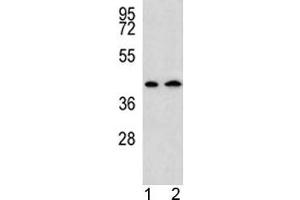 AADAT antibody western blot analysis in human 1) HepG2, and 2) Y79 lysate. (AADAT Antikörper  (AA 196-224))