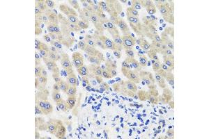Immunohistochemistry of paraffin-embedded human liver injury using HSD11B2 antibody (ABIN5995471) at dilution of 1/100 (40x lens).