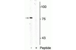 Western blot of rat mid brain membrane lysate showing specific immunolabeling of the ~76 kDa SERT protein phosphorylated at Thr276 in the first lane (-). (SLC6A4 Antikörper  (pThr276))
