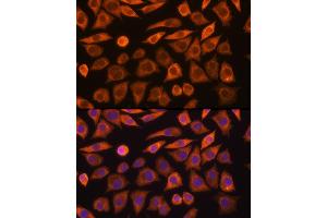 Immunofluorescence analysis of L929 cells using GUCY1 Rabbit pAb (ABIN6127969, ABIN6141533, ABIN6141534 and ABIN6216446) at dilution of 1:100 (40x lens). (GUCY1A1 Antikörper  (AA 1-120))