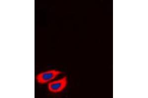 Immunofluorescence (IF) image for anti-Collagen, Type VI, alpha 2 (COL6A2) (Center) antibody (ABIN7295328)