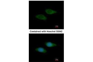 ICC/IF Image Immunofluorescence analysis of methanol-fixed HeLa, using SNTB2, antibody at 1:200 dilution. (SNTB2 Antikörper)