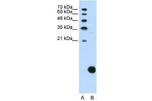 WB Suggested Anti-RPS29  Antibody Titration: 1. (RPS29 Antikörper  (N-Term))