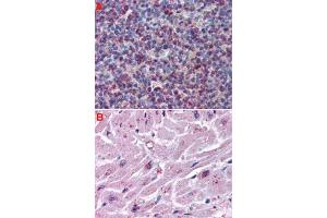 Immunohistochemistry (Formalin/PFA-fixed paraffin-embedded sections) of human spleen (A) and human heart tissue (B) with CYSLTR2 polyclonal antibody . (CasLTR2 Antikörper  (Extracellular Domain))