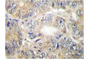 Image no. 1 for anti-Tumor Necrosis Factor (Ligand) Superfamily, Member 13 (TNFSF13) antibody (ABIN272145) (TNFSF13 Antikörper)