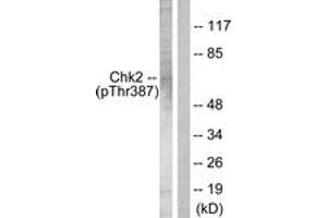 Western blot analysis of extracts from Jurkat cells, using Chk2 (Phospho-Thr387) Antibody. (CHEK2 Antikörper  (pThr387))