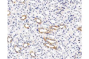 Immunohistochemistry analysis of paraffin-embedded rat kidney using MMP9 Monoclonal Antibody at dilution of 1:300.