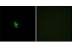Immunofluorescence analysis of HeLa cells, using OR52E1 Antibody. (OR52E1 Antikörper  (AA 201-250))