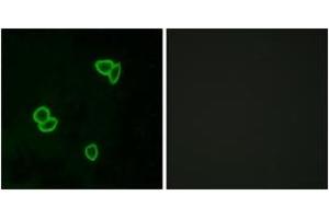 Immunofluorescence analysis of LOVO cells, using LPHN1 Antibody. (Latrophilin 1 Antikörper  (AA 561-610))