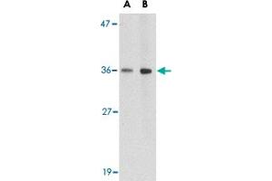 Western blot analysis of HAPLN2 in human brain tissue lysate with HAPLN2 polyclonal antibody  at (A) 1 and (B) 2 ug/mL . (HAPLN2 Antikörper  (Internal Region))