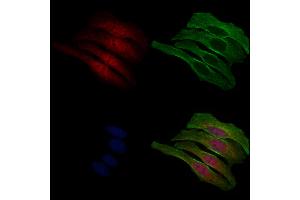 ABIN6265176 and ABIN6268795 staining Hela cells by IF/ICC. (SMAD4 Antikörper  (N-Term))