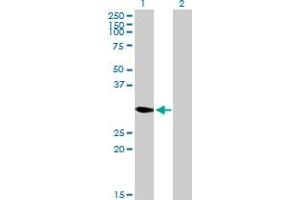 DECR2 Antikörper  (AA 1-292)