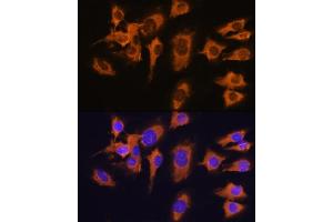 Immunofluorescence analysis of C6 cells using SLC20 antibody (ABIN1682754, ABIN3018562, ABIN3018563 and ABIN6220499) at dilution of 1:100. (SLC20A1 Antikörper  (AA 257-356))