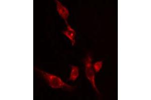 ABIN6274526 staining 293 cells by IF/ICC. (Ethanolamine Kinase 2 Antikörper  (Internal Region))