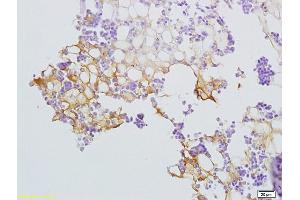 Formalin-fixed and paraffin embedded rat bone marrow labeled with Anti-SLC44A1/CD92 Polyclonal Antibody, Unconjugated (ABIN702370) at 1:200 followed by conjugation to the secondary antibody and DAB staining (SLC44A1 Antikörper  (AA 81-180))