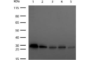 All lanes : C1QBP Rabbit mAb at 1/1k dilution Lane 1 : 293T whole cell lysates Lane 2 : A549 whole cell lysates Lane 3 : Hela whole cell lysates Lane 4 : HepG2 whole cell lysates Lane 5 : C2C12 whole cell lysates Lysates/proteins at 20 μg per lane. (Rekombinanter C1QBP Antikörper)