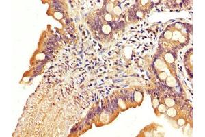Immunohistochemistry (IHC) image for anti-Solute Carrier Family 22 (Organic Cation Transporter), Member 23 (SLC22A23) (AA 3-206) antibody (ABIN7170148)